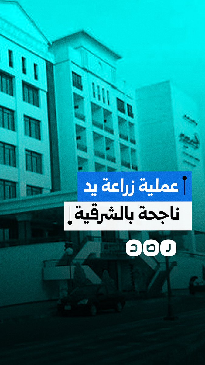 سابقوا الزمن.. حالة زراعة يد ناجحة لمريض في مستشفى الأحرار التعليمي بالشرقية