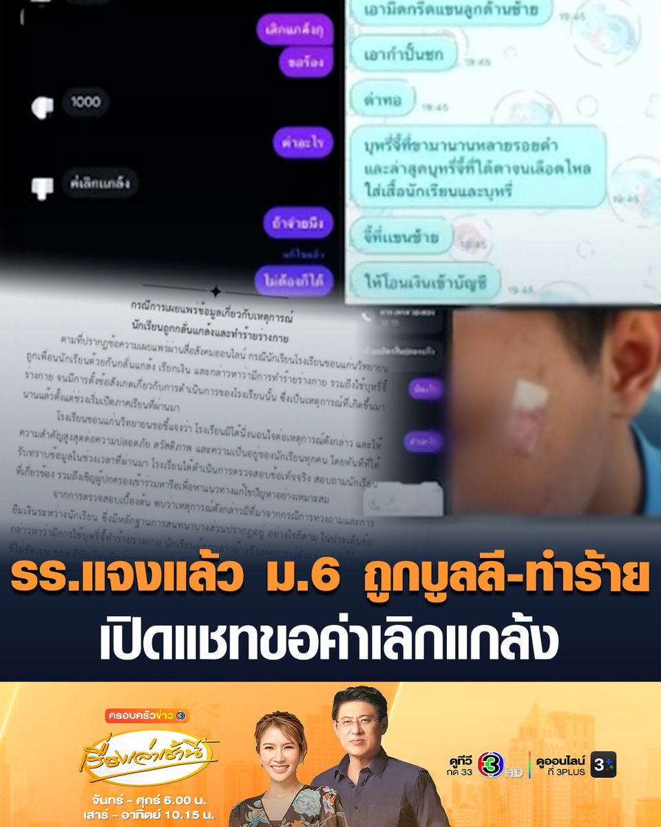 #เรื่องเล่าเช้านี้ โรงเรียนขอนแก่นวิทยายน แจงแล้ว ปมเด็ก ม.6 ถูกบูลลี กลั่นแกล้ง รีดไถเงิน ทำร้าย บุหรี่จี้ โดนแบบนี้มาตั้งแต่ ม.4 พ่อแม่พาแจ้งความ แต่ รร.ขอไกล่เกลี่ยให้ไม่เอาความ – เปิดแชทขอค่าเลิกแกล้ง #ข่าวช่อง3 #ครอบครัวข่าว3 #บูลลี #กลั่นแกล้งในโรงเรียน #ขอนแก่น