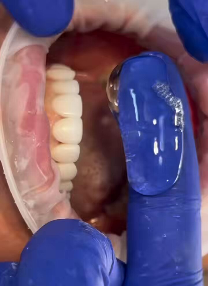 Her teeth look white and beautiful
