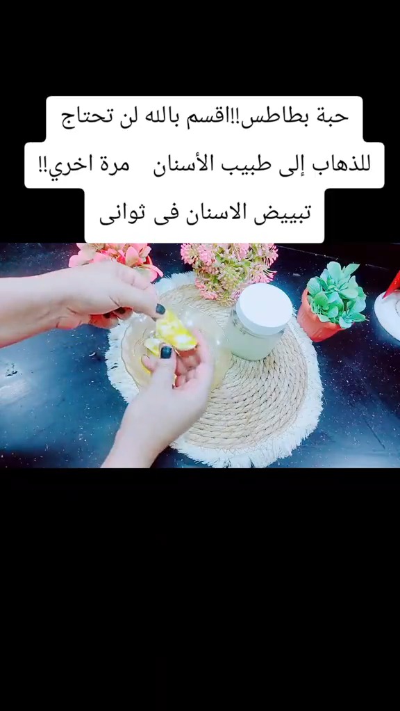 عن طريق البطاطا الموجودة في كل مطبخ طريقة تخليك أسنانك بيضاء وتزيل الجير المترسب