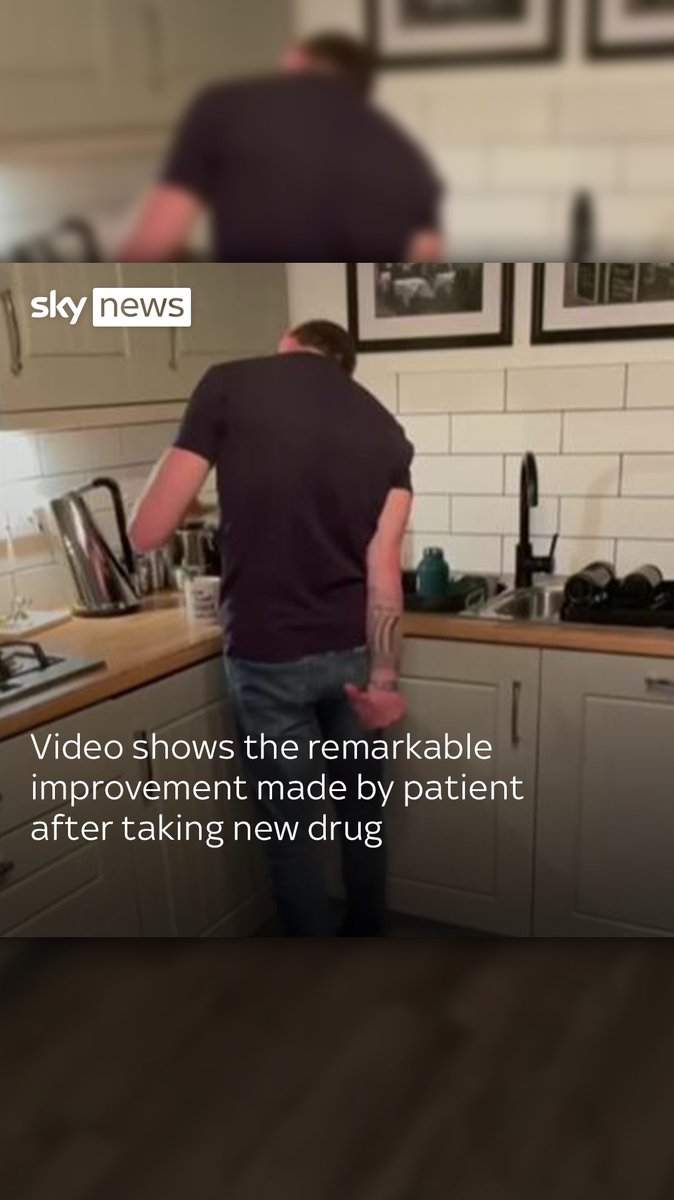 Before and after footage showing the improvement made by Gath, a Parkinson's patient after just two days on a new drug Produodopa treatment, after being diagnosed 12 years ago.