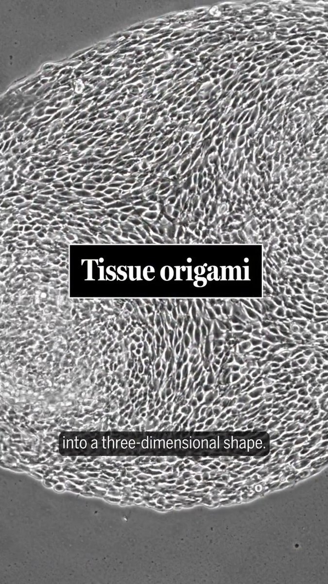 When cells grow together, they often align with their neighbors, forming liquid crystal-like patterns known as “nematic order.” But that order isn’t perfect, and at certain points, the alignment can break down, creating “topological defects”: small regions where cells swirl or fan out instead of lining up cleanly. And according to research published in Science, what looks like a defect can be used strategically as built-in instructions for shaping larger structures. Instead of growing upward, cells can store and release stress in certain places along a previously flat sheetlike structure, forming a bowl, a ridge, or a fold. Learn more:
