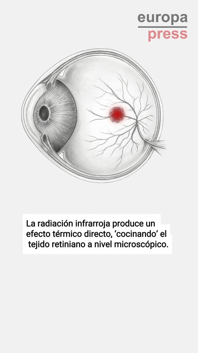 ¿Por qué mirar un eclipse sin protección es peligroso? ➡️La oscuridad provoca el crecimiento de la retina, lo que la vuelve más vulnerable no solo a la radiación que ve, sino a la que no ve, como la infrarroja o la ultravioleta
