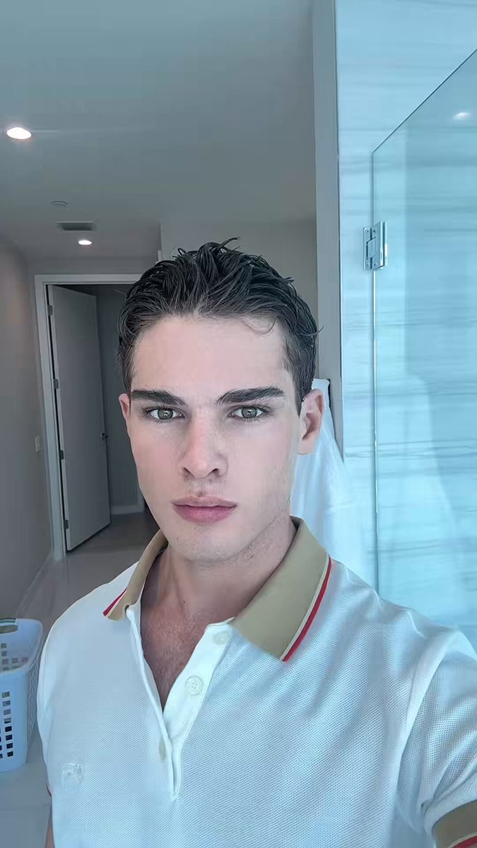 Clavicular posted this video on TikTok just now showing his healed face from the surgeries …
