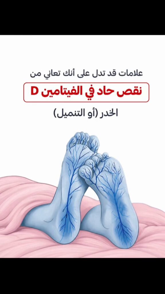 علامات تدل على نقص فيتامينات في جسمك؟؟