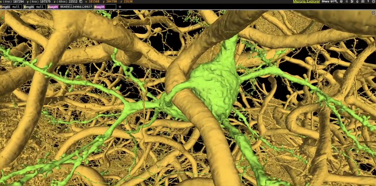 Holy Soma Batman! You never know what you may find when you cruise our MICrONS Explorer, such as a blood vessel piercing the soma of a neuron! 👀 See this incredible find up close using this shortcut: