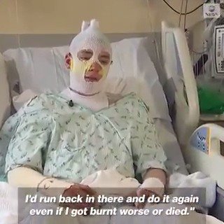 20-year-old Derrick Byrd charges back into a raging house fire to rescue his 8-year-old niece, suffering severe burns on his face, arms, and back. His words? "I'd do it again—even if I got burnt worse or died." True heroism! 🔥❤️