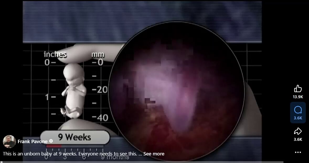 This is an unborn baby at 9 weeks. Everyone needs to see this. Video Credit