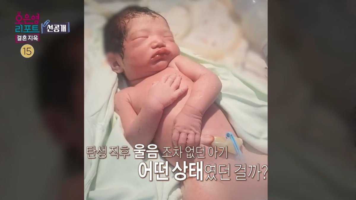 [선공개] 탄생 직후 울음조차 없던 아기 어떤 상태였던 걸까? <#오은영리포트결혼지옥> [월] 밤 9시 방송 💌 #오은영리포트 #오은영리포트_결혼지옥 #결혼지옥 MBC 260817 방송 ⓒ MBC&amp;iMBC 무단 전재, 재배포 및 이용(AI학습 포함)금지