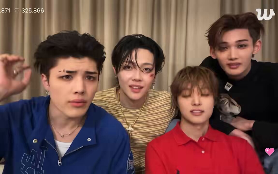 🐶the reason i dyed my hair is because it was just...it's like, you couldn't really tell what color it is. it was just like a rlly weird colour like in between brown and red and purple and i didn't like it. it looked like...it looked like unko (shit) THE SHOCKED FACES ARE FMU😭