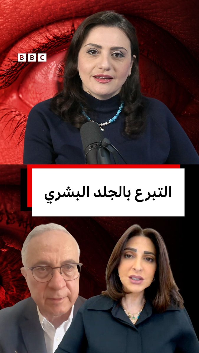 لا يزال التبرع بالجلد مفهوماً غير شائع في مجتمعاتنا العربية، رغم أهميته في علاج الحروق الشديدة والحد من مضاعفاتها. من القاهرة، تناقش الدكتورة هبة السويدي والبروفيسور نعيم مؤمن هذه القضية في بودكاست يستحق الانتباه. رابط الحلقة: