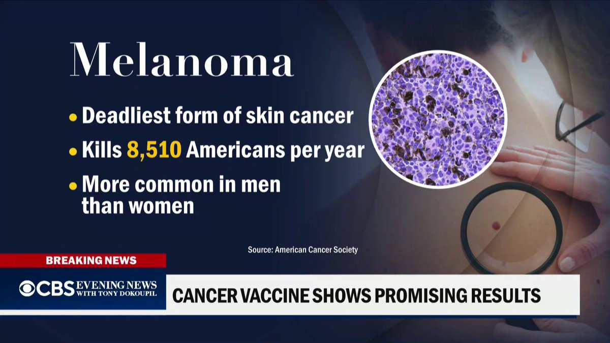 Moderna announced a successful experimental mRNA vaccine to treat melanoma, the deadly skin cancer from which more than 8,500 people in the U.S. are expected to die this year. CBS News’ Chief Medical Correspondent Jonathan LaPook, M.D has more on the study.