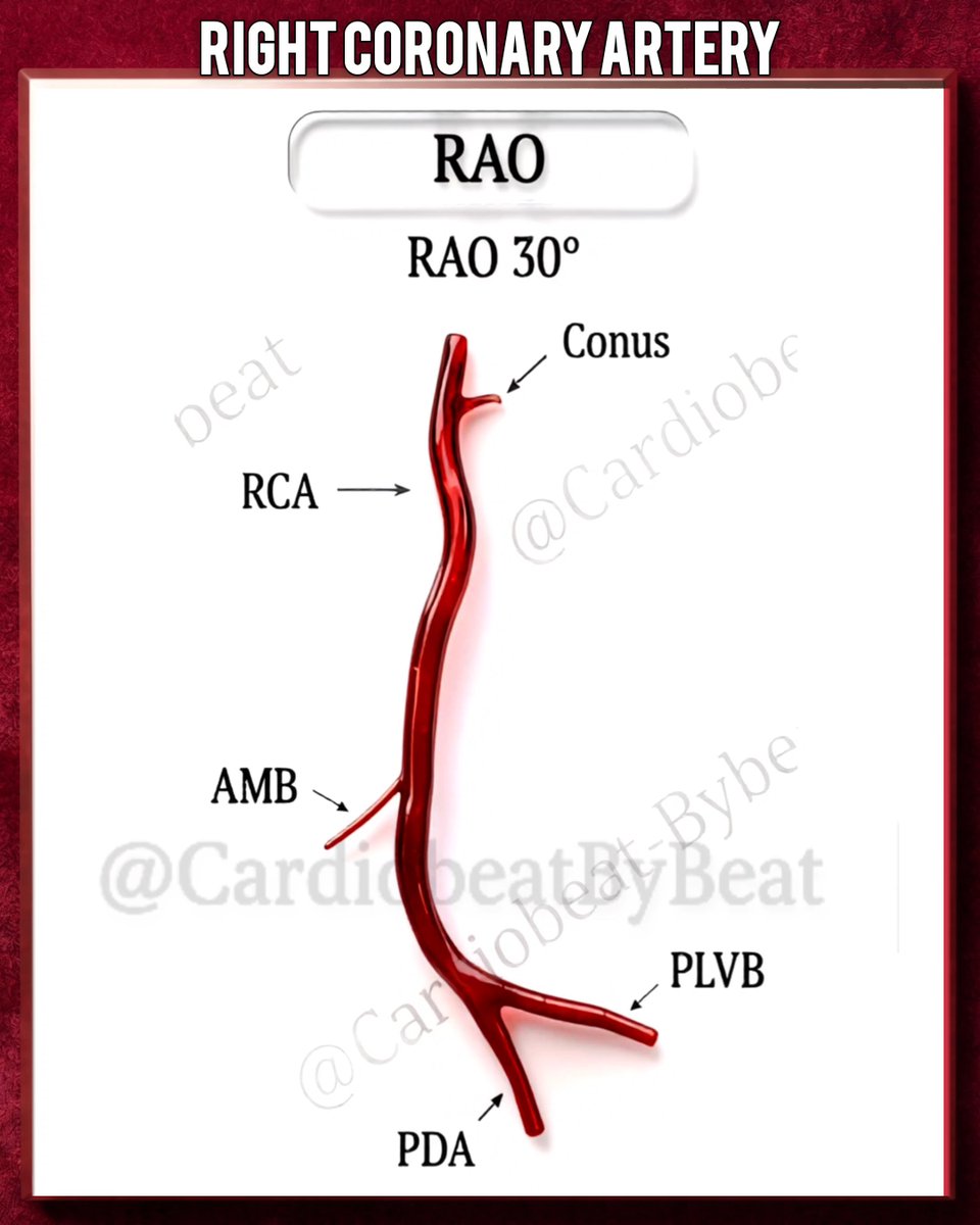 LCA. RCA. All projections. All branches. One visual. Everything you need. โ
Bookmark this before your next cath.๐ฉโจ #Cardiology #Interventional #CathLab #MedEd #Anatomy