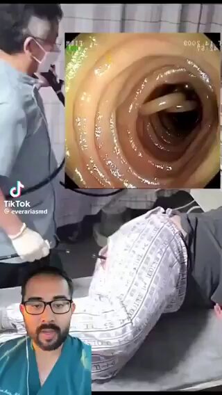 رجل اجرى منظار قولون بسبب مشاكل في بطنه وخلال الفحص اكتشف الطبيب شيء غريب داخل الأمعاء واضطر يتدخل ويشيله على طول ولما عرفوا وش كان الشيء انصدموا ؟!! متى آخر مرة أخذت علاج للديدان؟