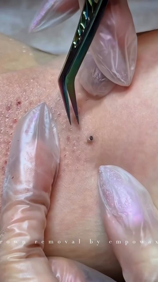 This is definitely going to hurt