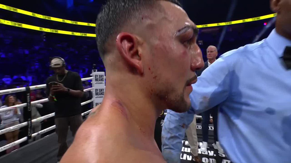 ¡NUEVO CAMPEÓN WÉLTER WBA! Teofimo Lopez derrotó por decisión mayoritaria a Rolly Romero. ¡Ya es campeón en su tres divisiones!