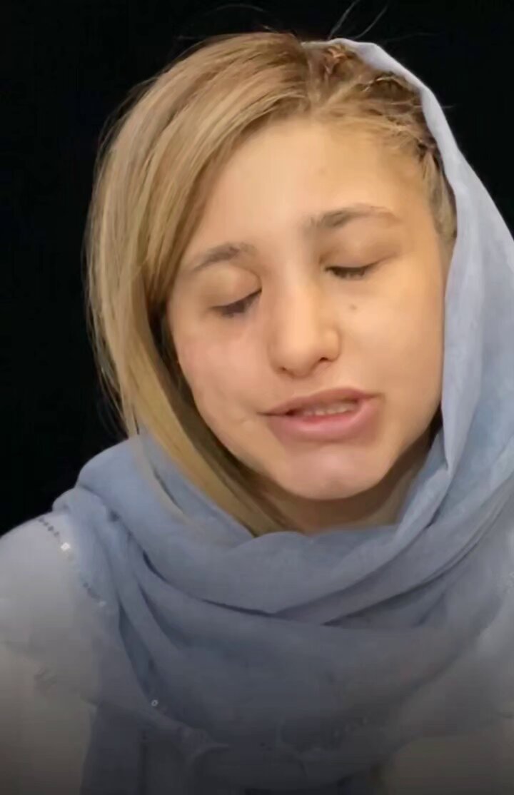 نتیجه نگهداری از سگ داخل خونه میشه این فاجعه حالا هی برید سگ بخرید کلی خرجش کنید تهش چنین بلایی سر دختر بچه هاتون بیاره آینده و زندگی و جوونیشو به همین راحتی فدای یه سگ کنید