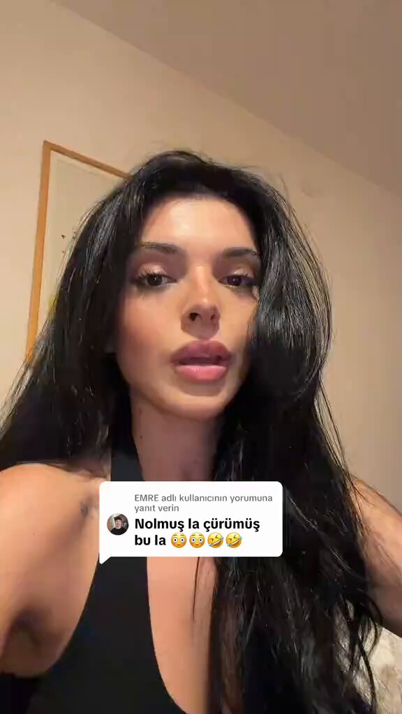 Ünlü komedyen ve disco kralı Ali Biçim’in kardeşi Eda Biçim vücudu ile ilgili yorumlara cevap verdi: 🔹 Dünden beri bu yorumu o kadar çok alıyorum ki. 🔹 Yani sırf beni biraz daha fazla zayıf gördünüz diye "çürümüş" ya da "yüzüm çökmüş" ya da "sarılık geçiriyor" ya da "hasta değilimdir" diye düşünüyorum. 🔹 Çünkü dünden beri yemediğim laf kalmadı gerçekten. 🔹 Hiçbir şekilde bana zayıflığı da yakıştırmıyorsunuz galiba, ben anlamadım ki bana neyin yakıştığını ben gerçekten anlamadım. 🔹 Çünkü 2 sene önceki popüler yorumlarımda şunlardı: "Bir kilo ver artık", "Bir tut ağzını artık", "Balon gibi oldun", "Bilmem ne, obez misin?" 🔹 Bunlardı, e şimdi kilo verdik. 🔹 O da yani hani, bu arada tabii ki kilo verdim ve güzel bir kilo verdim ama zargana da değilim yani ya da yıkılmıyorum mesela zayıflıktan. 🔹 Hani bunu başkalarına o tarz duruyorlar ve kötü duruyorlar diye söylemek istediğimden söylemiyorum. 🔹 Sadece herkesin belli bir prototipi varsa, ben istesem de oraya gelemiyorum çünkü vücut yapım bu. 🔹 Yani mal belli, istese de o kadar zayıflayamaz, anladın mı? 🔹 Ya neden bu an buna bu kadar hani içerlendin? 🔹 İçerlendin derseniz de, ay dünden beri bir sürü hakaret altındayım ben de anlamadım yani. 🔹 Ha ha çürüdüm. 🔹 Evet hastalıktan bak öldüm, bittim, geberiyorum. 🔹 Bu seni mutlu ederse, sen ona inanmaya devam et, ne diyeyim yani. 🔹 Her zayıflayan illa hasta, sıkıntılı, çürümüş, ay çökmüşsün sen mi? 🔹 Bilmiyorum bana mı tuhaf geliyor?
