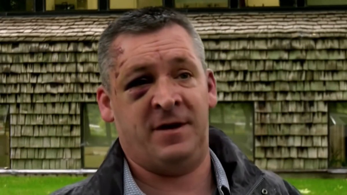 SASKATOON: A man celebrating his birthday on Saturday was viciously attacked by teens as he walked home Ross Smith says he was randomly bear sprayed & beaten unconscious as his friend ran for help. Saskatoon Police confirm assaults are up 75% with 177 incidents so far this year