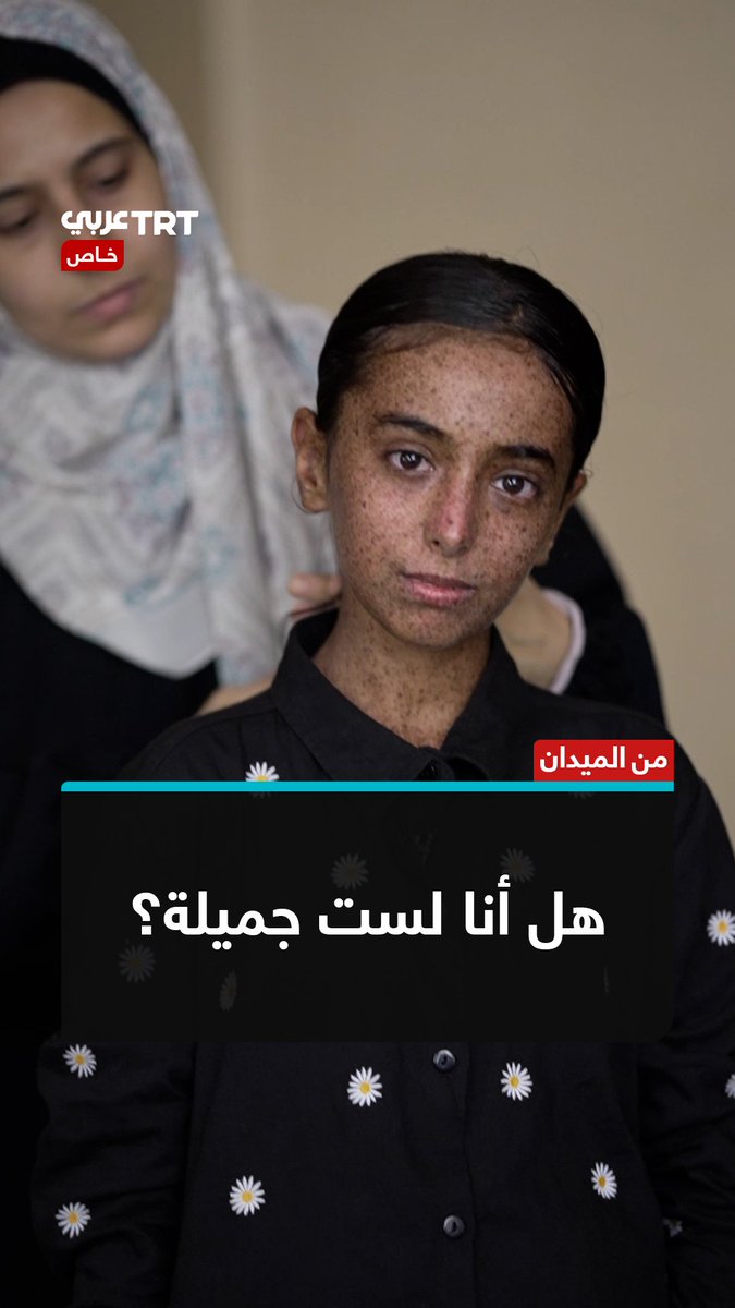 "أتمنى ألا يتنمّر عليّ أحد".. طفلة فلسطينية مصابة بمرض نادر يحرمها من الخروج تحت أشعة الشمس واللعب مع صديقاتها، بينما تنتظر علاجاً خارج #غزة لتجنّب مضاعفات خطيرة. TRT عربي.. #حكايات من الميدان