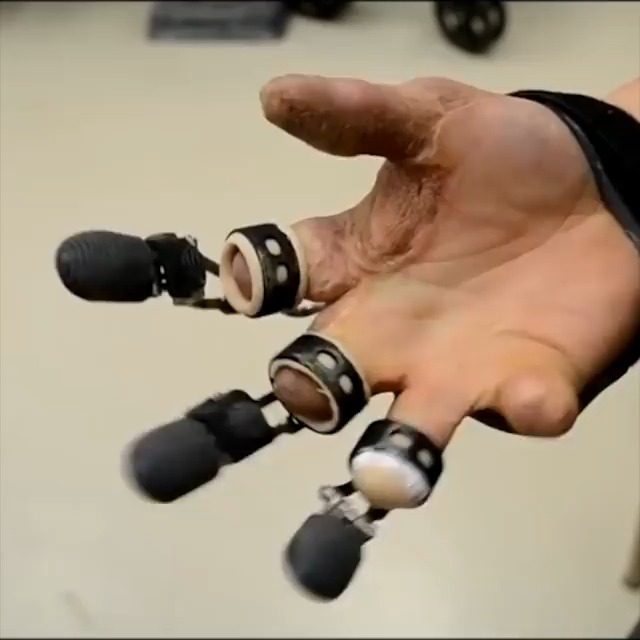 この義手!本当にすごいな…。シンプルなつくりなのに、かなり巧緻性を必要とする動作まで、損傷側で実施できてる。どんな仕組みになってるんだろう。フル電動&AIとかに比べるとコスト的にも抑えられそうですし…どこかの国際学会の展示ブースで体験してみたいです