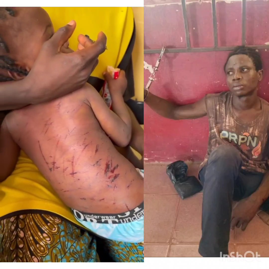 VIEWERS WARNING; A man reportedly used a wire to beat his 2-year-old daughter in Delta State for allegedly refusing to greet him in the morning.