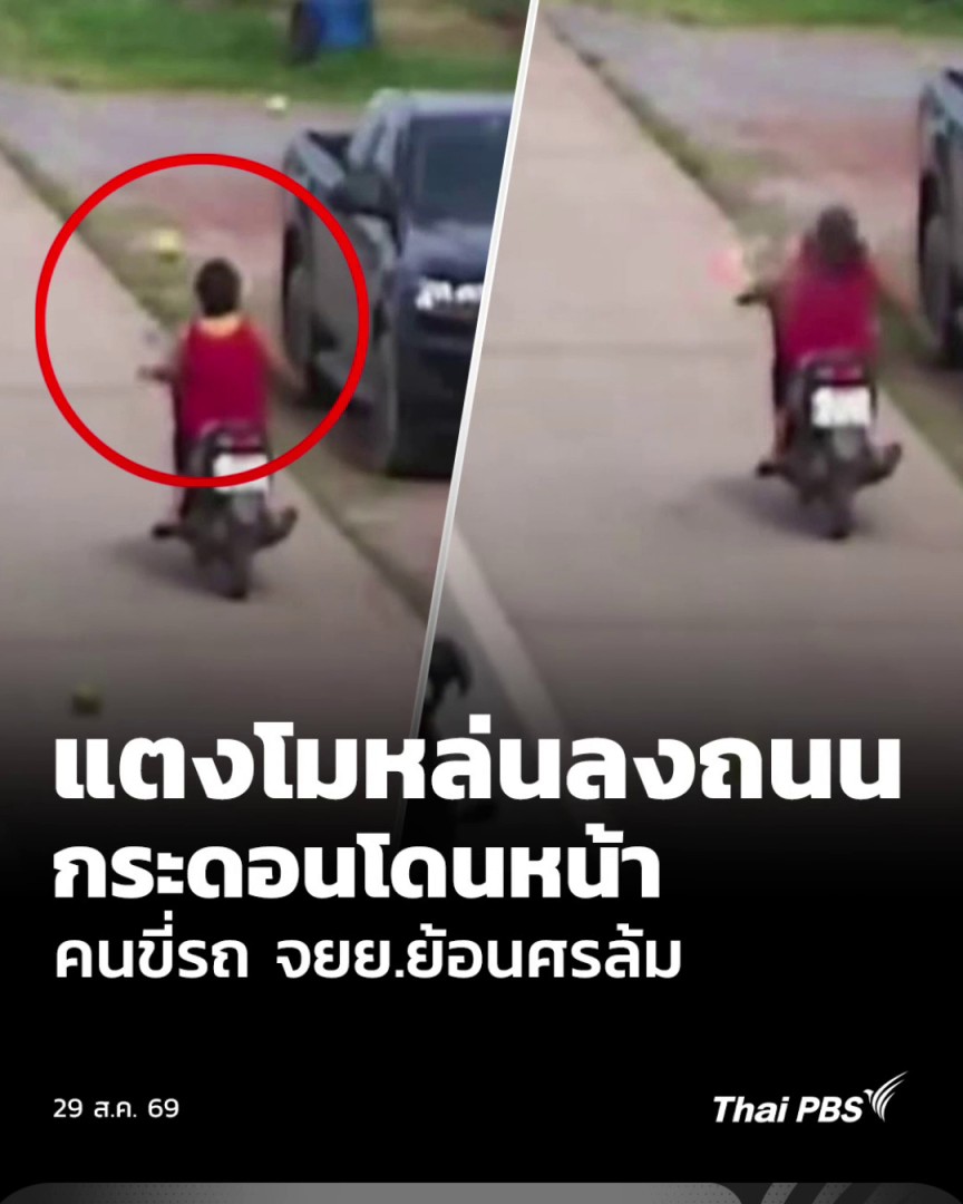 เพียงเสี้ยววินาที ก็อาจเกิดอุบัติเหตุได้ เหตุการณ์นี้รถจักรยานยนต์ขี่มา แต่ถุงใส่ของขาด เพียงวินาทีเดียวแตงโม 4 ลูกหล่น กระเด้งโดนหน้าคนที่ขี่รถ จยย.ย้อนศรมาแบบเต็ม ๆ จนมีคำถามตามมาว่า แบบนี้ใครต้องจ่ายค่ารักษา ? #ThaiPBS #ชั่วโมงข่าวเสาร์อาทิตย์
