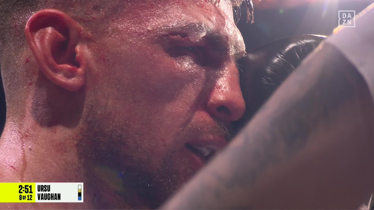 The fight is stopped by the doctor due to a deep cut on the eye brow of Ben Vaughan 🤕 🎟️ Buy #MosesHrgovic NOW at | Live Now | Watch only on DAZN ▪️