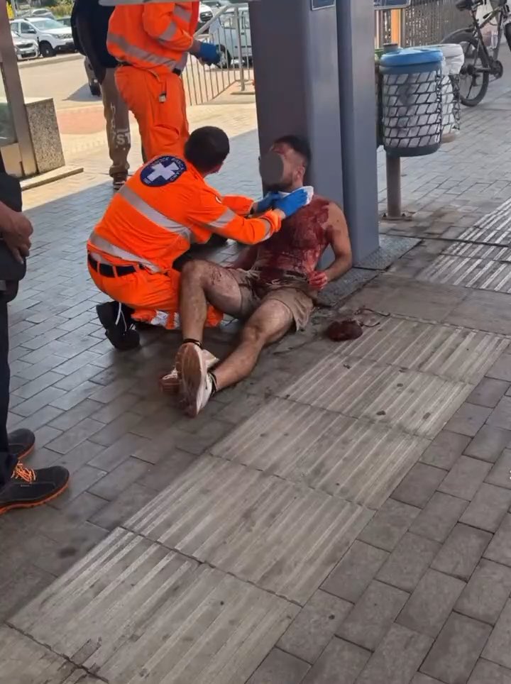 San Giuliano Milanese, Italy 🇮🇹: Three Moroccan men stab a US tourist in the throat and face on a train to steal his gold necklace. “I don’t want to die,” the young man says. This is the state European cities have been reduced to.