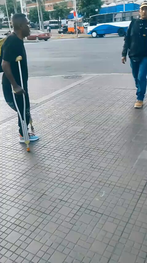 The Funniest One-Legged Prank😂