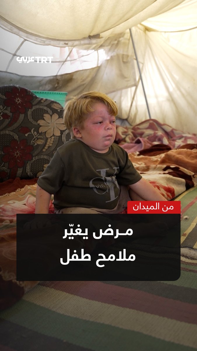 "يتغير شكله وينتفخ بطنه يوماً بعد آخر"... طفل في غزة يعاني تضخماً في الكلى والكبد والتهابات مؤلمة في وجهه، فيما تحاول والدته تخفيف معاناته في ظلّ غياب العلاج. TRT عربي.. #حكايات من الميدان
