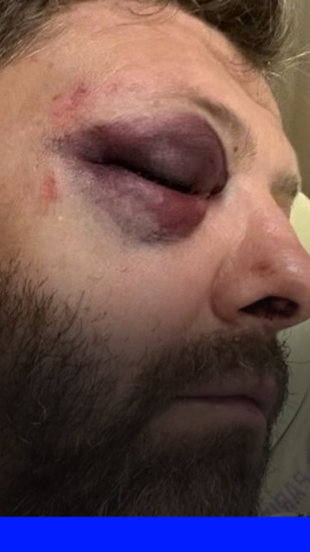 "Je vais te tuer sale p***": un policier victime d'une agression homophobe à Paris témoigne