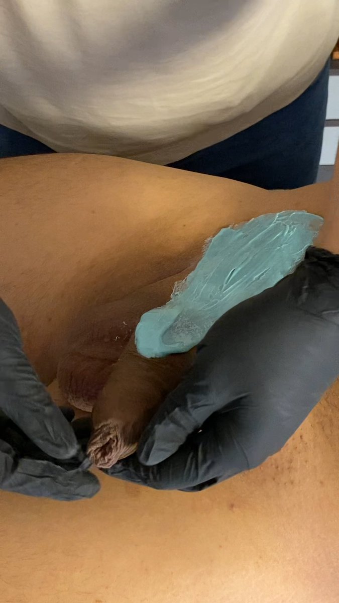 Proceso de depilacion zona íntima #waxing #manscaping #brozilian #depilacion #cl #man