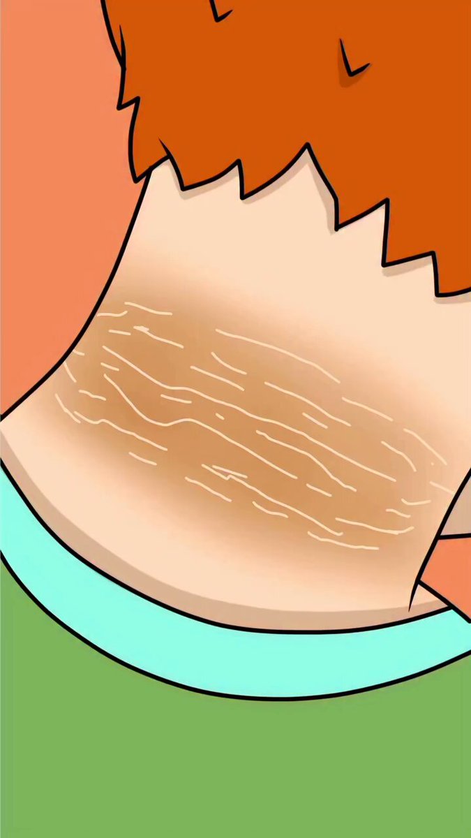 Why the dark patch on your neck won’t wash