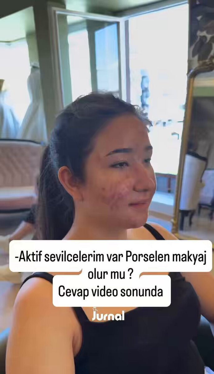 Aktif sivilce problemi yaşadığını söyleyen gence yapılan makyajın aşamaları ve sonucu paylaşıldı.