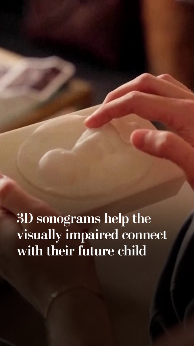 These 3D-printed tactile sonograms help visually impaired expectant parents experience their baby's image. The ridges and shapes allows people to trace the position and contours of the baby before birth.