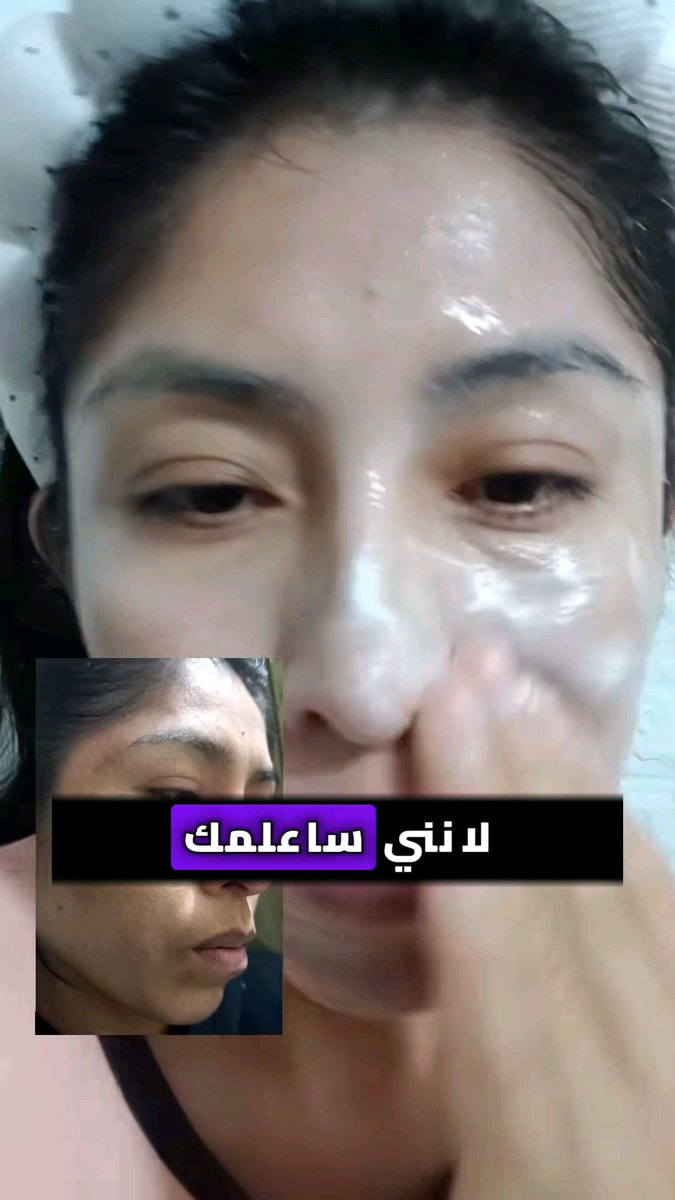 للنساء فقط... اصنعي هذا البوتوكس في البيت بمكونين فقط بيخلي بشرتك كانها بشرت بنت بعمر 20 عام حتى وان كان عمرك فوق 50 سنة 🤯