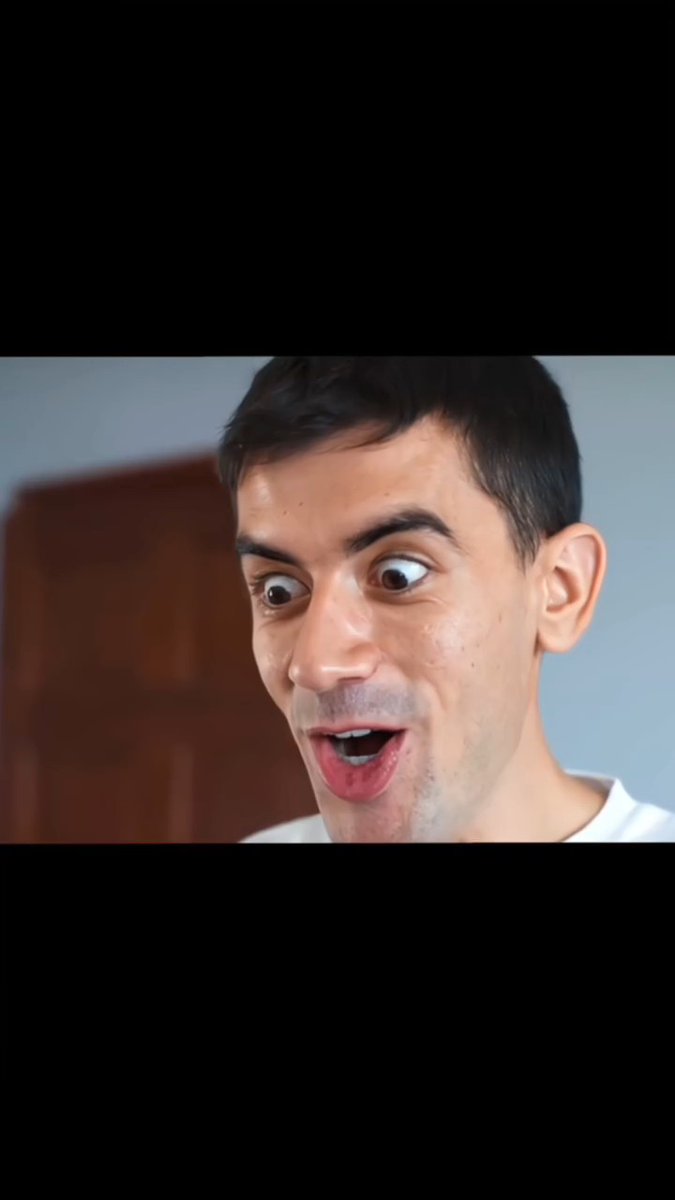 When Your Friend Says Something Normal… But Your Face Says, “Wait, WHAT?”💀👀