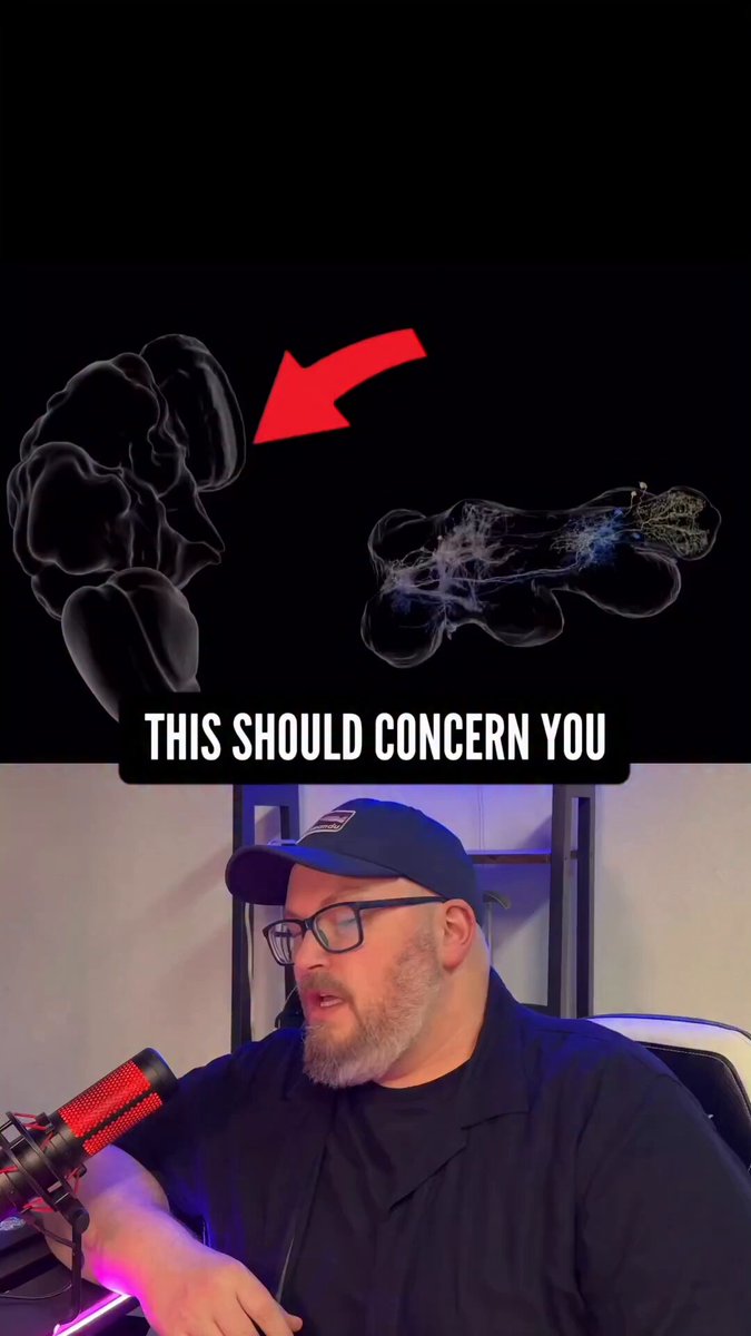 They’re uploading brains online now… 🧠