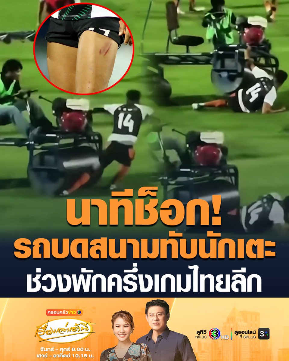 #เรื่องเล่าเช้านี้ นาทีช็อก! “แอนดรอส ทาวน์เซนด์” อดีตนักเตะพรีเมียร์ลีก โดนรถบดสนามทับ ขณะกำลังวอร์มอยู่ในสนาม ระหว่างพักครึ่ง ในเกมไทยลีก 1 บาดเจ็บ แต่ยังกลับมาลงสนามได้ในช่วงท้ายเกม และ พีที ประจวบ เอฟซี บุกชนะ ปัตตานี เอฟซี 3-0 #ครอบครัวข่าว3 #ข่าวช่อง3 #ไทยลีก #รถบดหญ้าทับขา