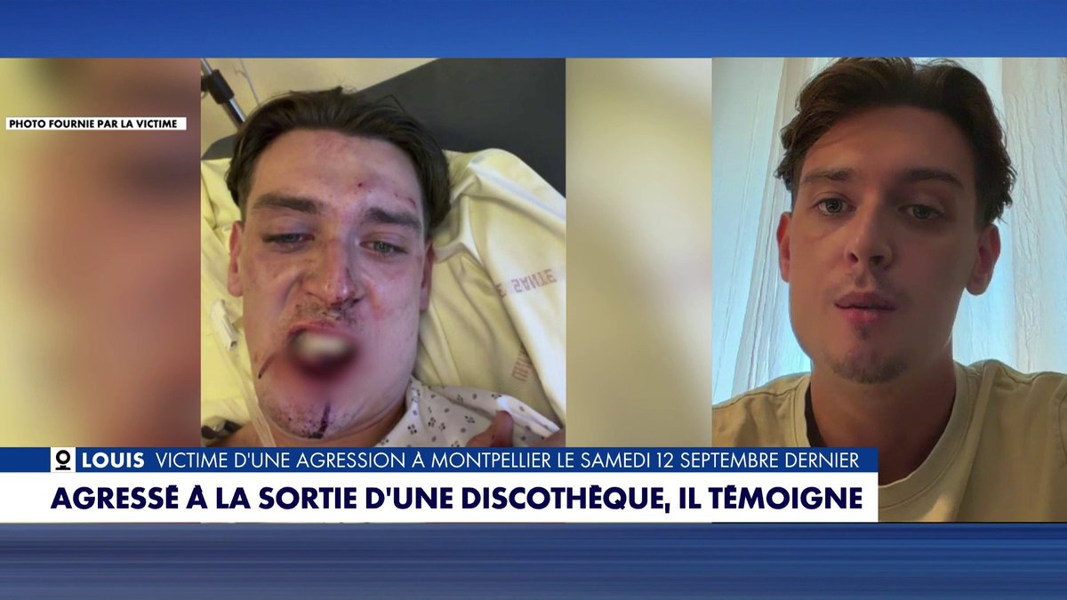 «Moralement, c’est pas facile, il n’y a pas un jour qui passe sans que je n’y pense» témoigne Louis dans #LaMatinale. Agressé à la sortie d’une boîte de nuit à Saint-Jean-de-Védas (Hérault), il a écopé de 42 jours d’ITT.