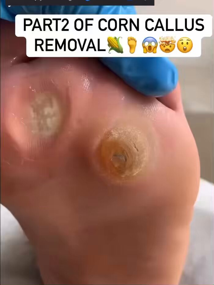 You won’t believe what was hiding under all that hard skin 😳