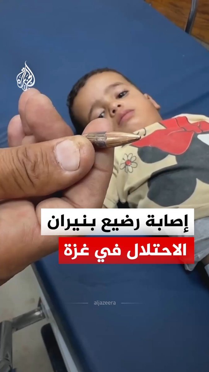 إصابة طفل رضيع بعيار ناري إسرائيلي في فخذه أثناء نومه في إحدى خيام النزوح في مواصي خان يونس جنوبي قطاع غزة #فيديو