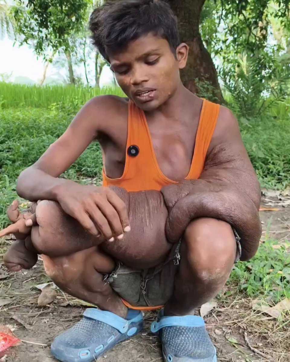 हर किसी का जीवन आसान नहीं है आपको जो मिला हर किसी को नहीं मिला है🥹