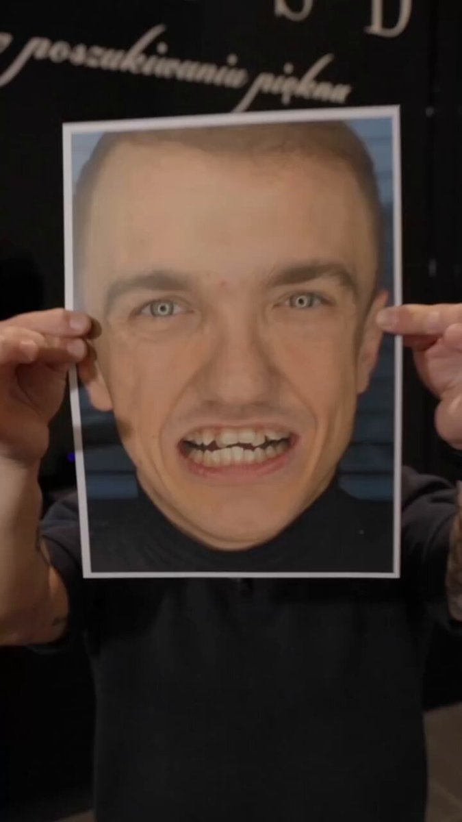 Mini Majk pochwalił się ogromną metamorfozą swojego uzębienia⤵️
