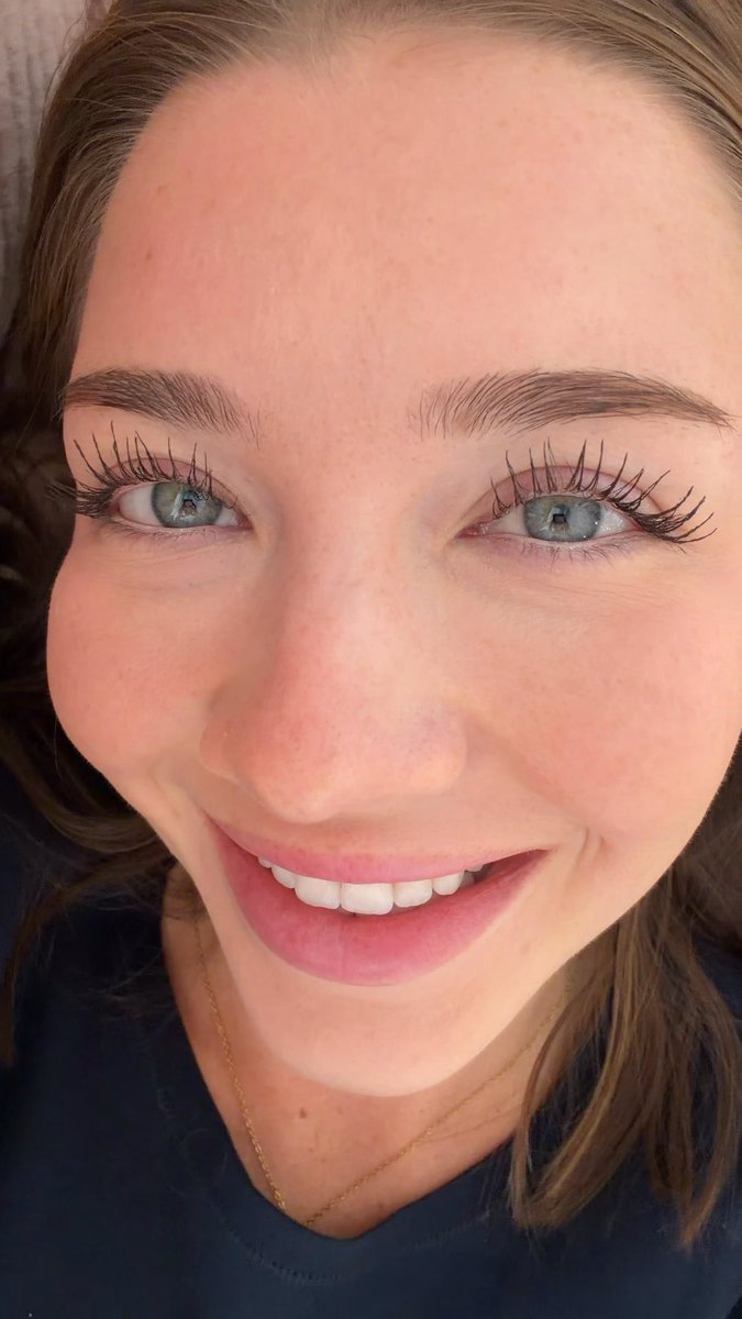 windows to the soul 💖