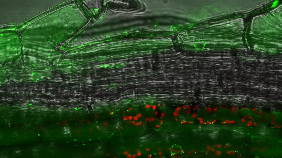 Everyone knows the mitochondria is the "powerhouse of the cell." But have you seen how beautifully its movement was captured by Dr. Patrick C. Hickey in this 5th place #SmallWorldInMotion winning video? 🏆 Now you have!