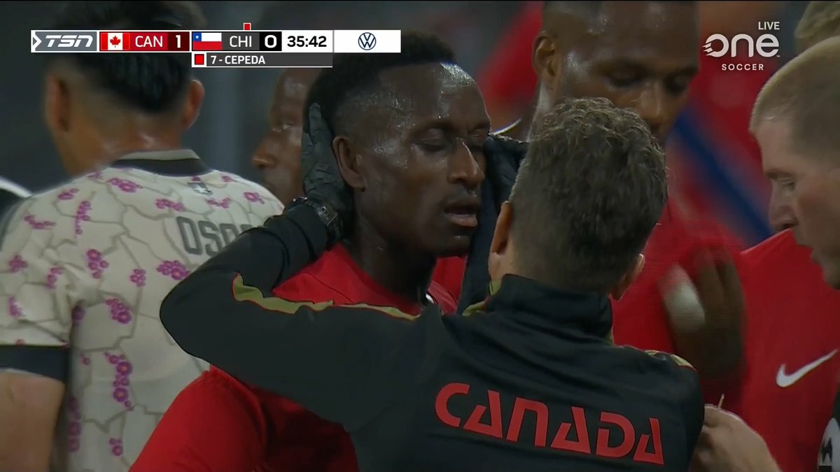 👀Vaya acción en el Canadá-Chile 🔴El jugador del Elche Lucas Cepeda engancha a Laryea y le tira una patada directa al rostro 🟥Sangre para el canadiense y roja para el chileno
