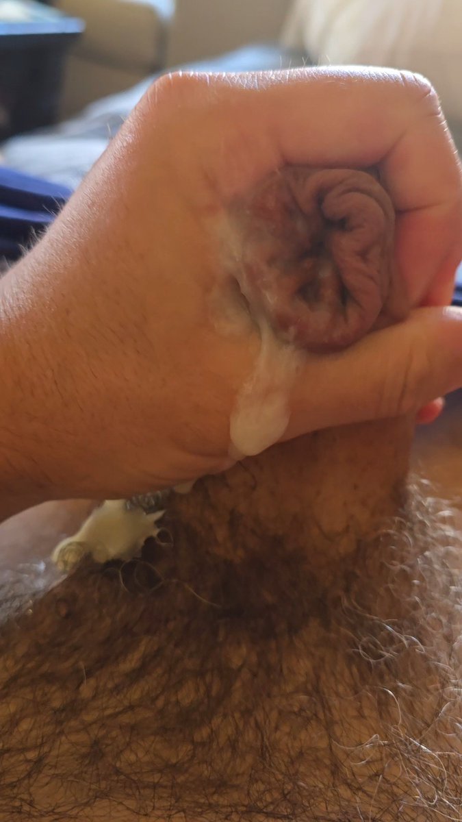 Tried to catch the nut in time but couldn't hold on. But was able to hold the load in my foreskin. Look at all that skin bro! I'm so proud of that! 💪🏻 ° #foreskin #foreskinrestoration #dick #uncutdick #prepuce #prepucio #goon #gooner #batebro #cum #cumshot #chudai