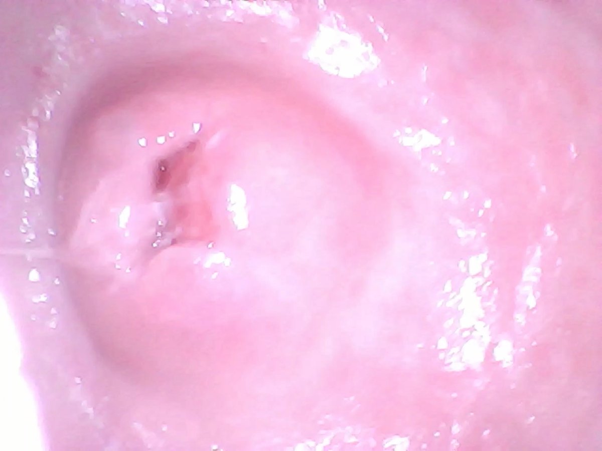 We finally got an endoscope camera and I’ve never seen such a close up of my cervix before 🫣👀 Mr. Wilson gets the bestttt shots 🤤🥵 #couple #couplescontent #married #marriedcouple #real #realcouple #endoscope #cervix #cervixview #internal #internalview #slutwife #wife #milf #kinky #loosepussy #bucketpussy #pussygape #gapedpussy #satisfied #fetish #kink #kinkfriendly #adultcontent #thewilsonsafterdark #nsfw #goon #goonette #fulllength #customcontent #smallmilf #smallwife #petitewife #petitemilf #sizequeen #bluecollar #bluecollarhusband